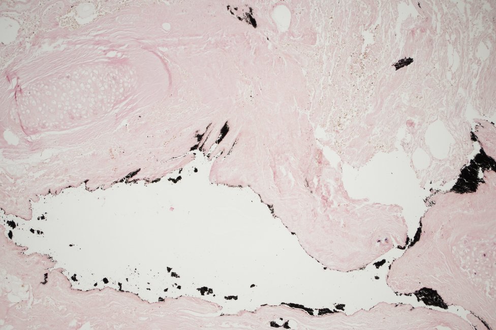 © MedUni Wien / Katharina Stolz