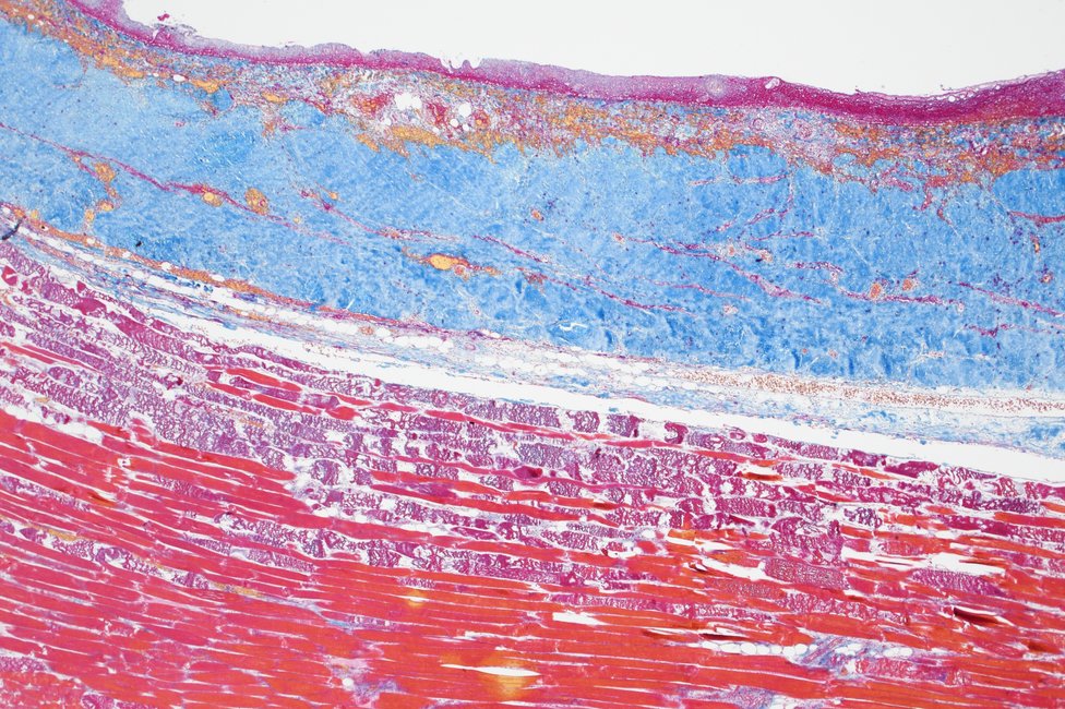 © MedUni Wien / Katharina Stolz