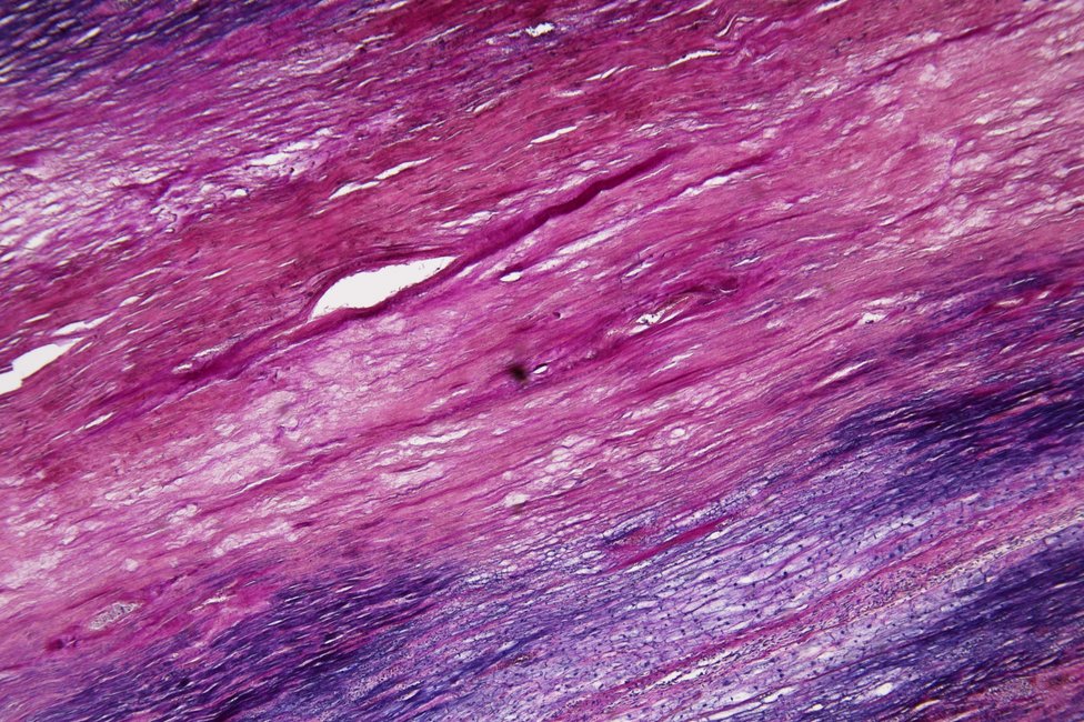 © MedUni Wien / Katharina Stolz