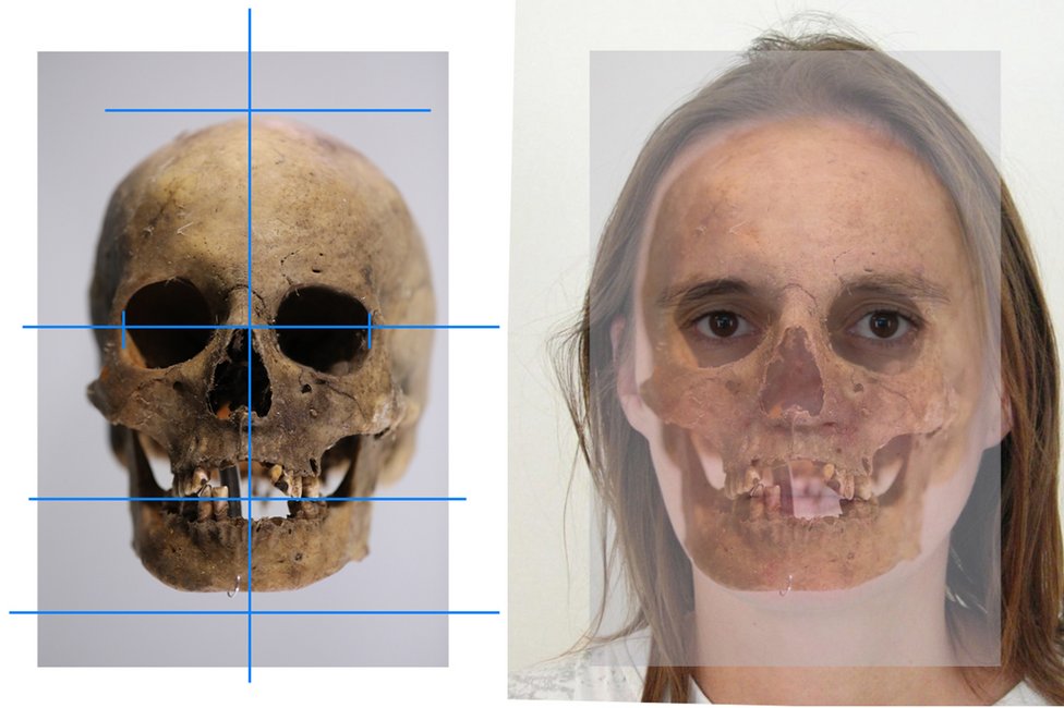 © MedUni Wien / Fabian Kanz