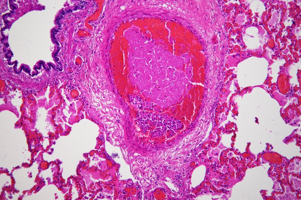 © MedUni Wien / Katharina Stolz
