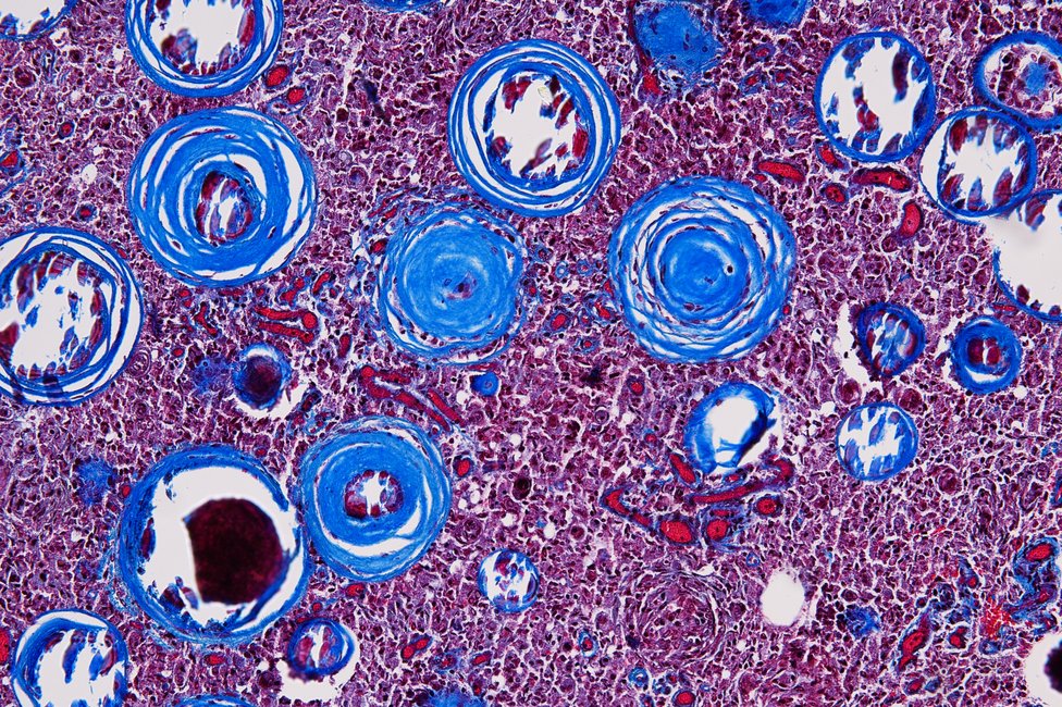 © MedUni Wien / Katharina Stolz