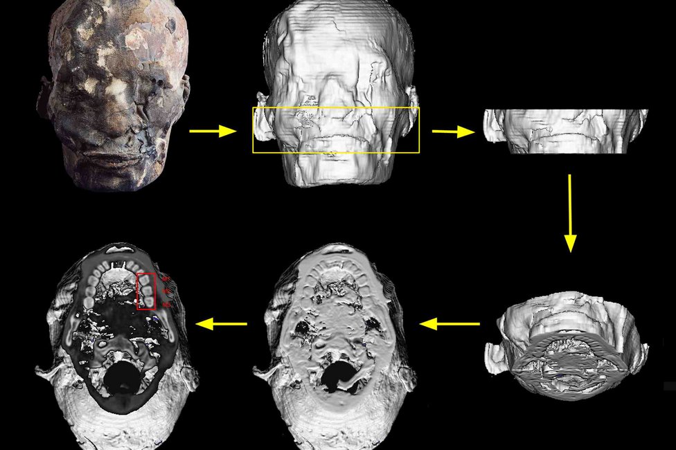 © MedUni Wien / Fabian Kanz