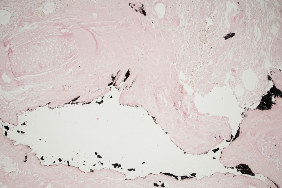 © MedUni Wien / Katharina Stolz