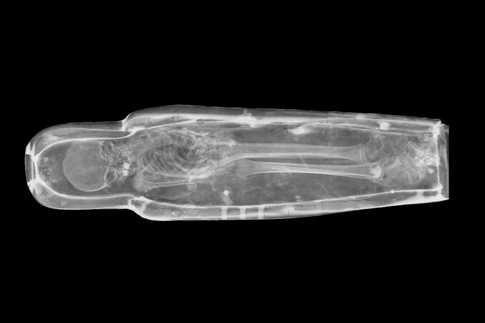 © MedUni Wien / Fabian Kanz